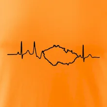 EKG Česká republika EKG Česká republika