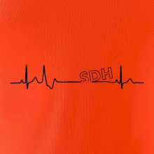 SDH EKG