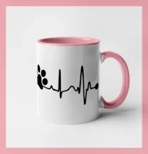 Ekg psia labka Ekg psia labka