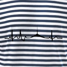 Ekg Jeseníky Ekg Jeseníky