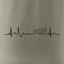 SDH EKG
