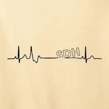 SDH EKG