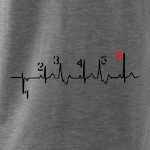 Moto EKG radenie Moto EKG radenie