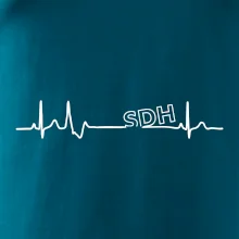 SDH EKG SDH EKG