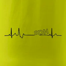 SDH EKG