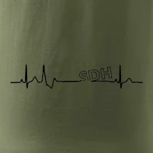 SDH EKG SDH EKG