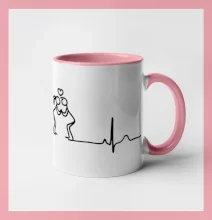 EKG zamilovaný pár EKG zamilovaný pár