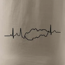 EKG Slovensko