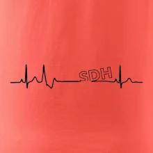 SDH EKG