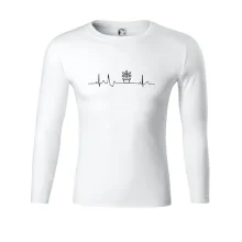 EKG fíkus EKG fíkus