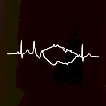 EKG Česká republika