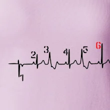 Moto EKG radenie Moto EKG radenie