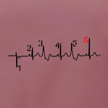 Moto EKG radenie Moto EKG radenie