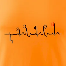 Moto EKG radenie Moto EKG radenie