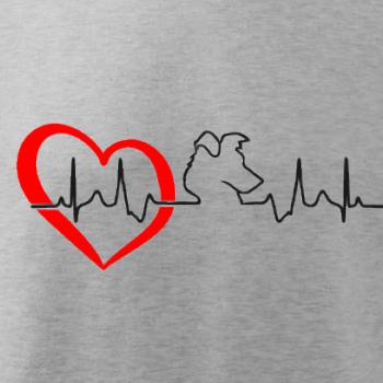 Borderská kólia EKG Borderská kólia EKG