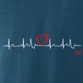 Moje srdce bije pre SKI Moje srdce bije pre SKI