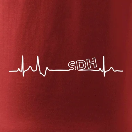 SDH EKG
