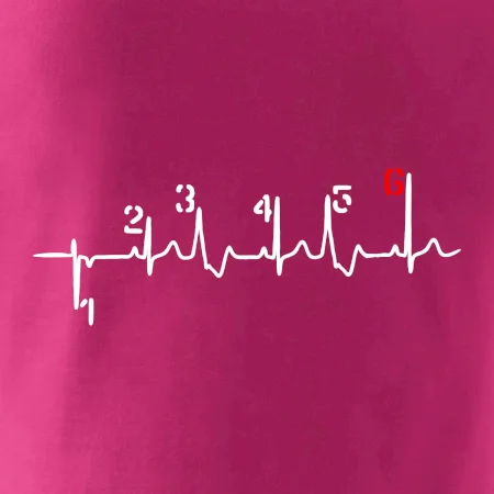 Moto EKG radenie