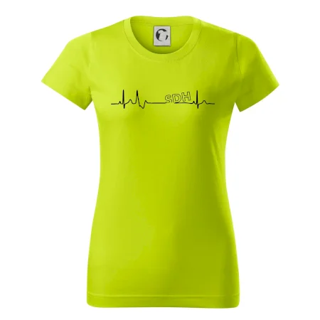 SDH EKG