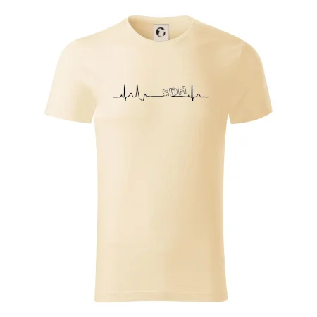 SDH EKG