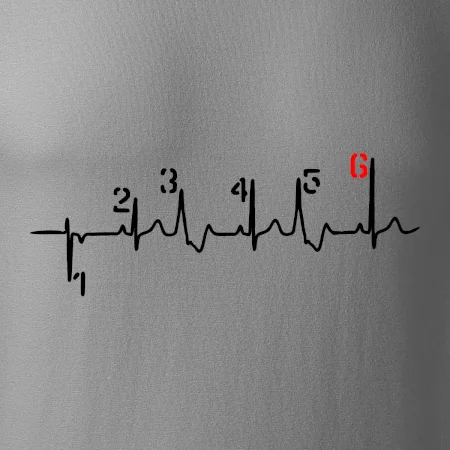 Moto EKG radenie
