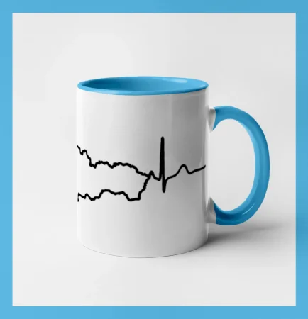 EKG Slovensko