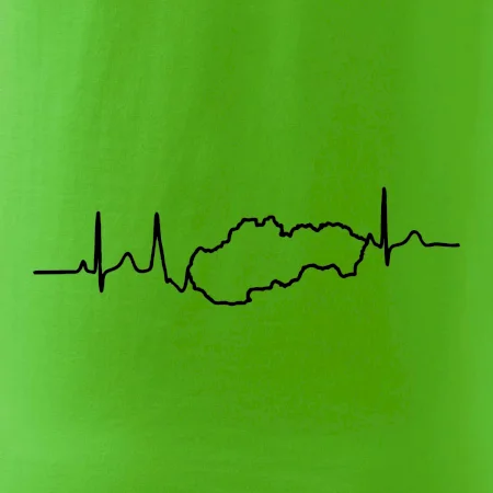 EKG Slovensko