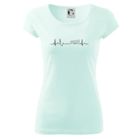 SDH EKG