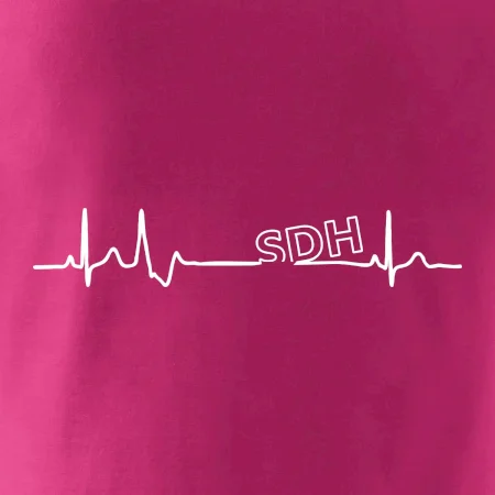 SDH EKG