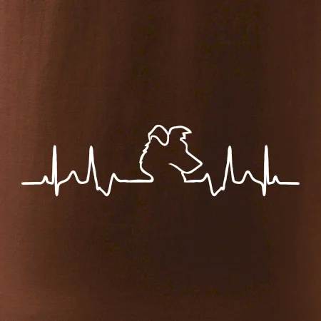 Borderská kólia EKG