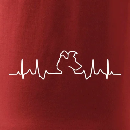 Borderská kólia EKG