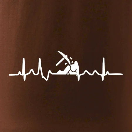 Ekg Baník