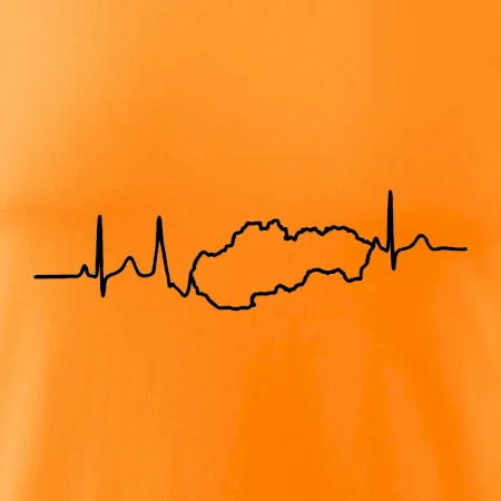 EKG Slovensko