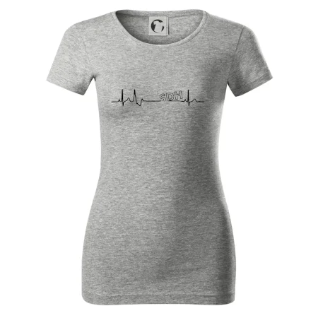 SDH EKG