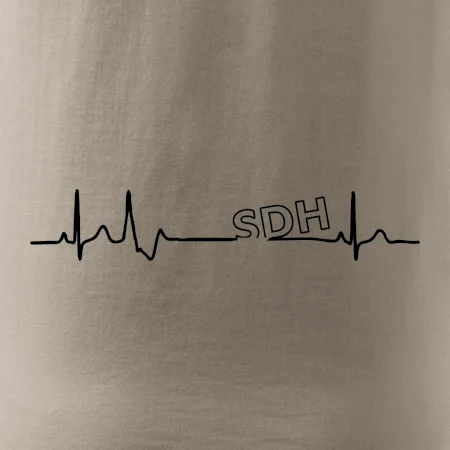 SDH EKG