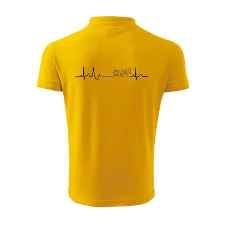 SDH EKG