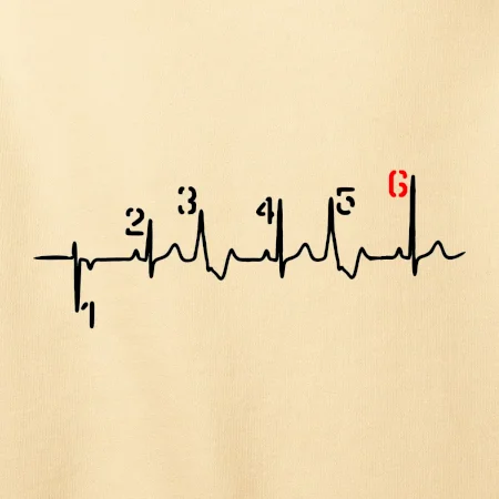 Moto EKG radenie
