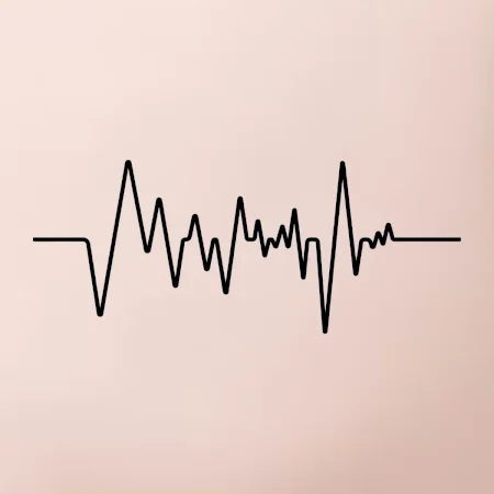 Ekg samostatné