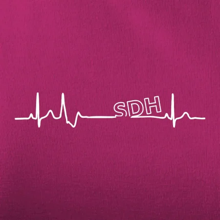 SDH EKG