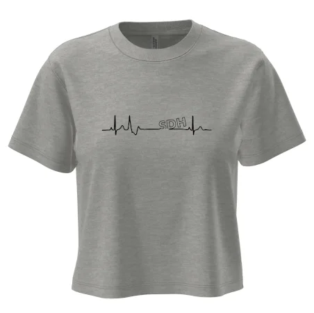 SDH EKG
