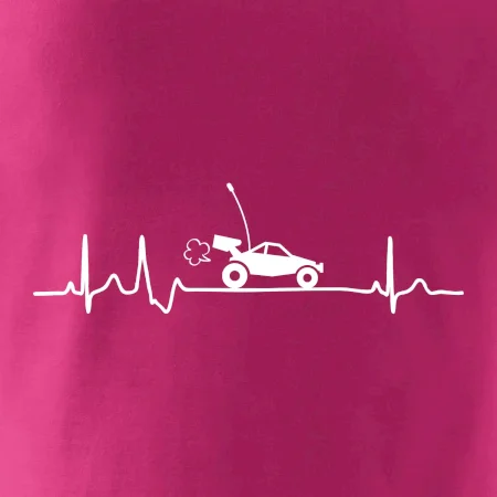 EKG RC model