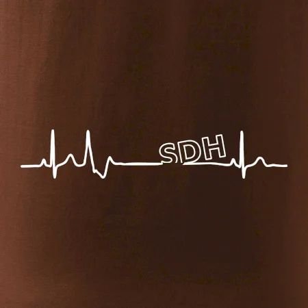 SDH EKG