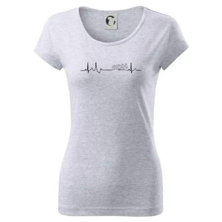 SDH EKG