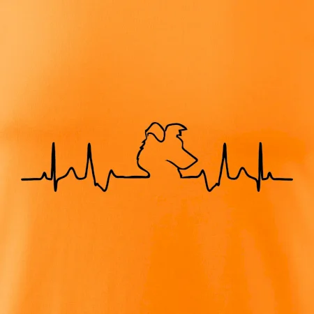 Borderská kólia EKG