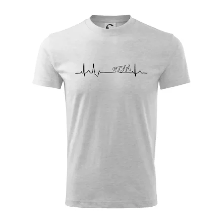 SDH EKG