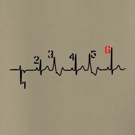 Moto EKG radenie