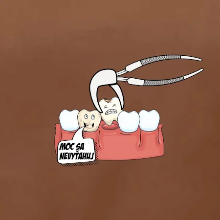 Moc sa nevyťahuj - zubár