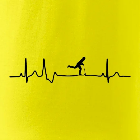 EKG kolobežky