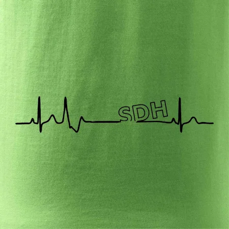 SDH EKG