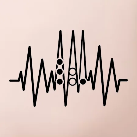 Backgammon  EKG